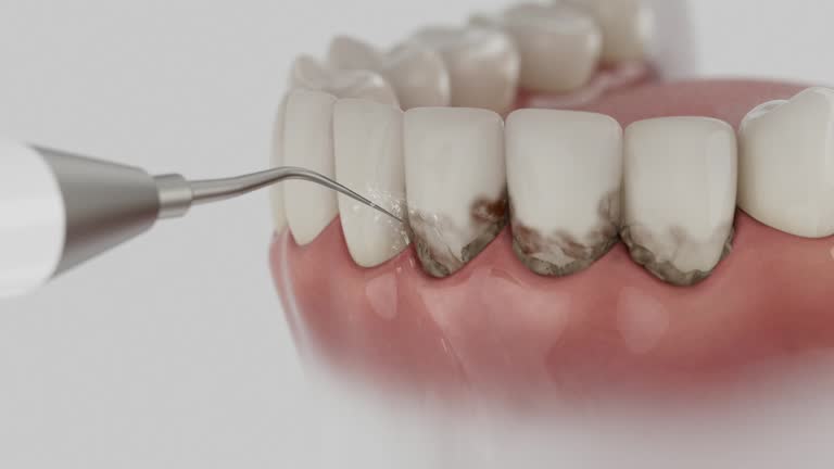 Reliable Dental Implants contractor in Sacaton, AZ by Smile Center Dentistry